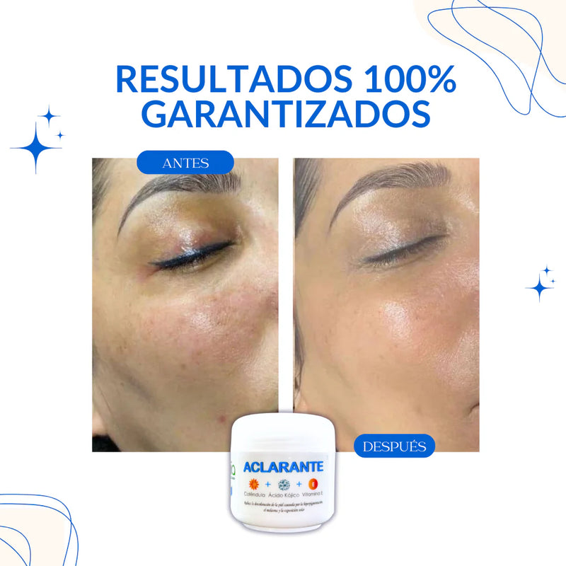 Crema Aclarante Rejuvenecedora Manchas Oscuras - COMPRA 1 Y LLÉVATE 2